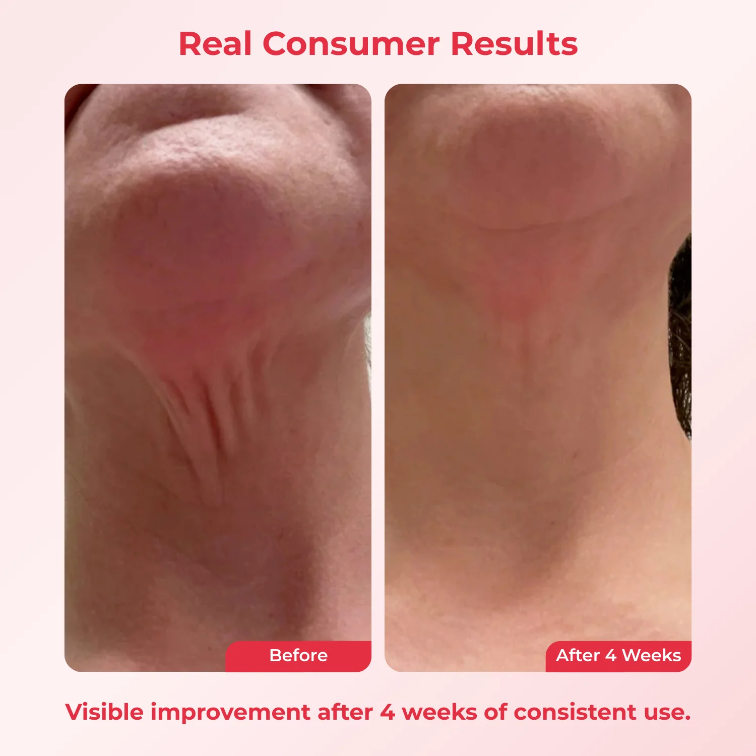Koriderm™ Time Reverse Neck Cream - Image 5